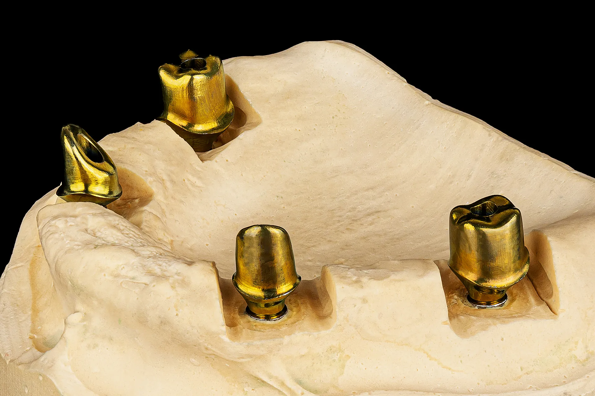 Abutments 3