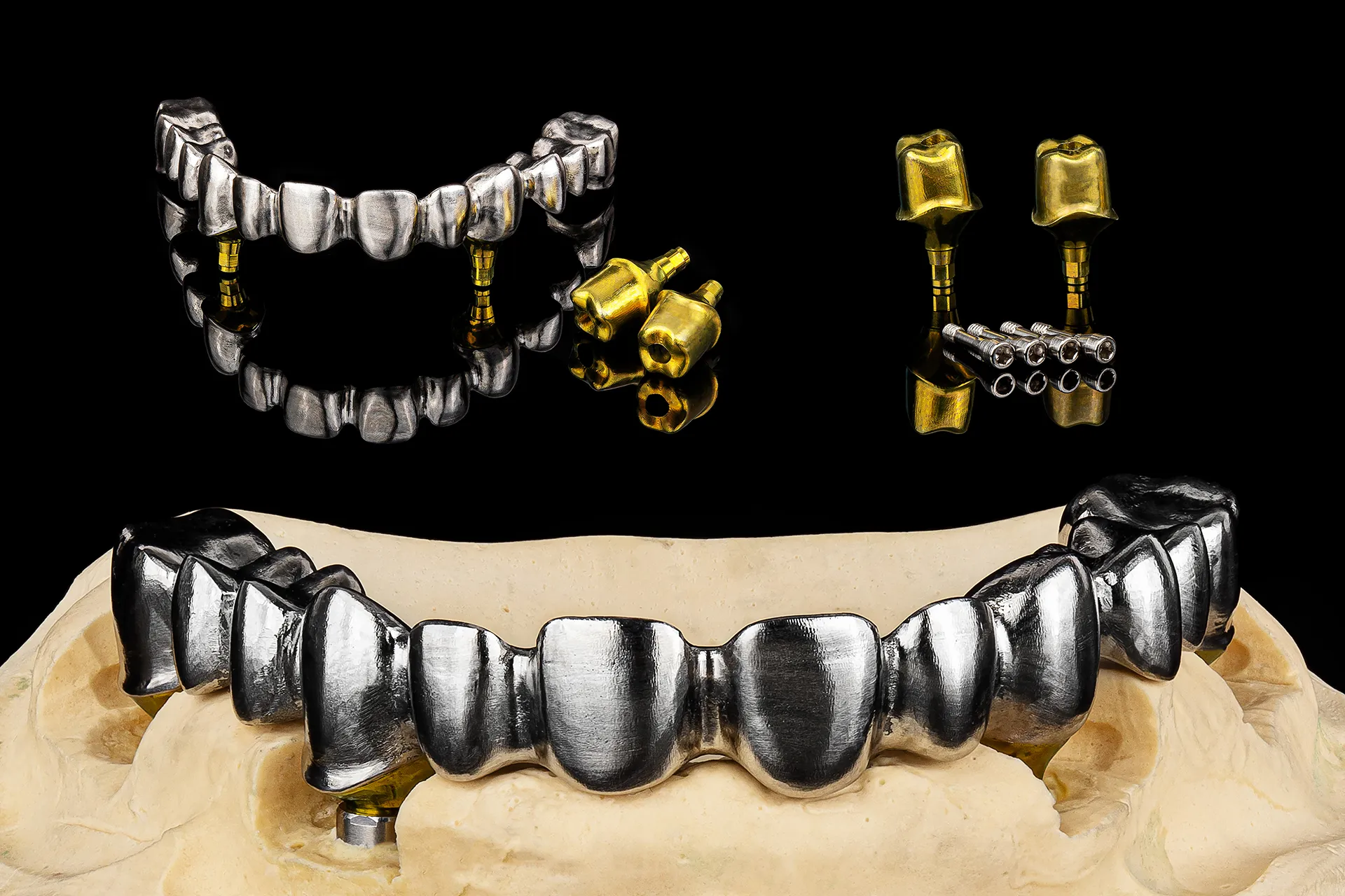 Abutments 6