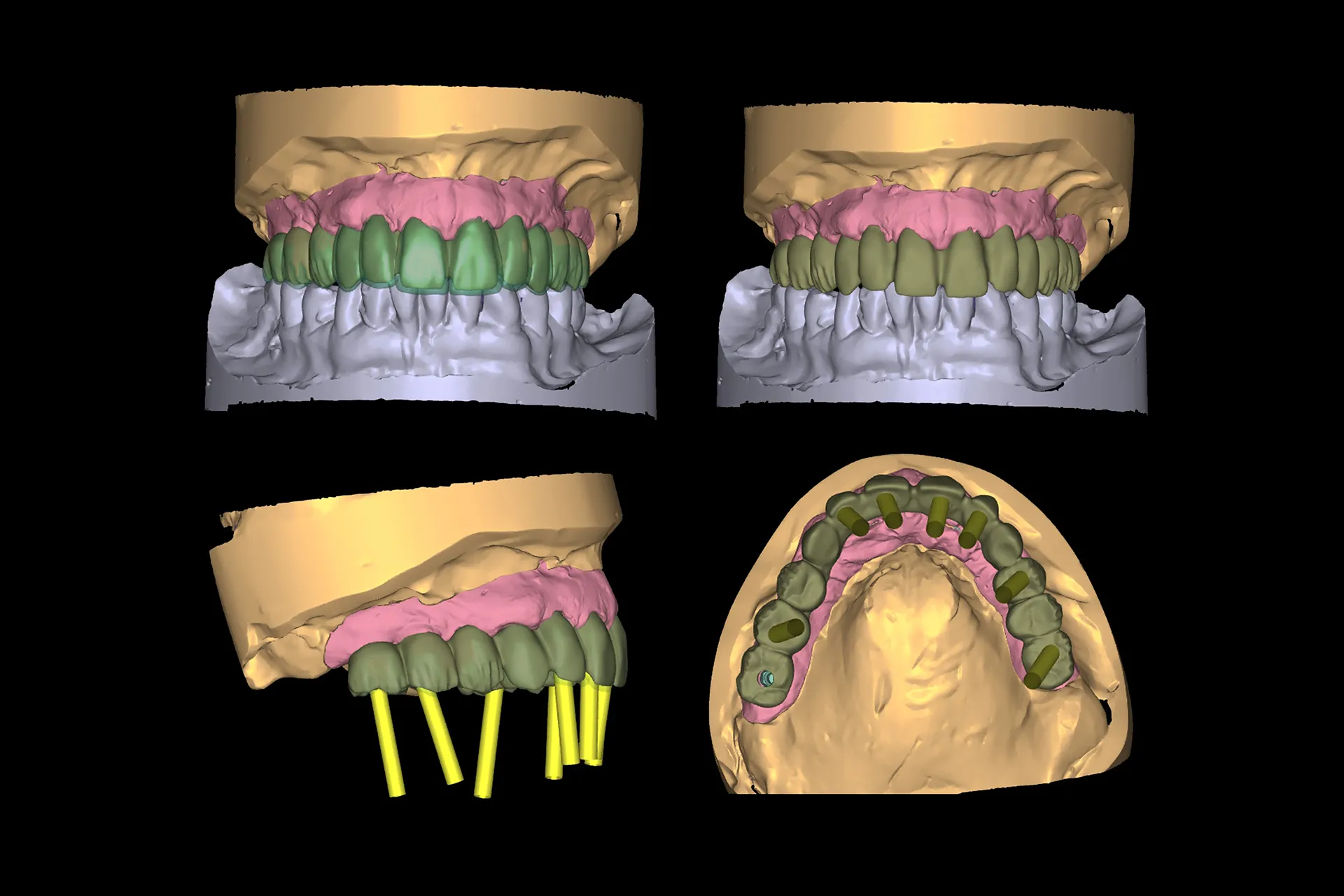 Cad 2