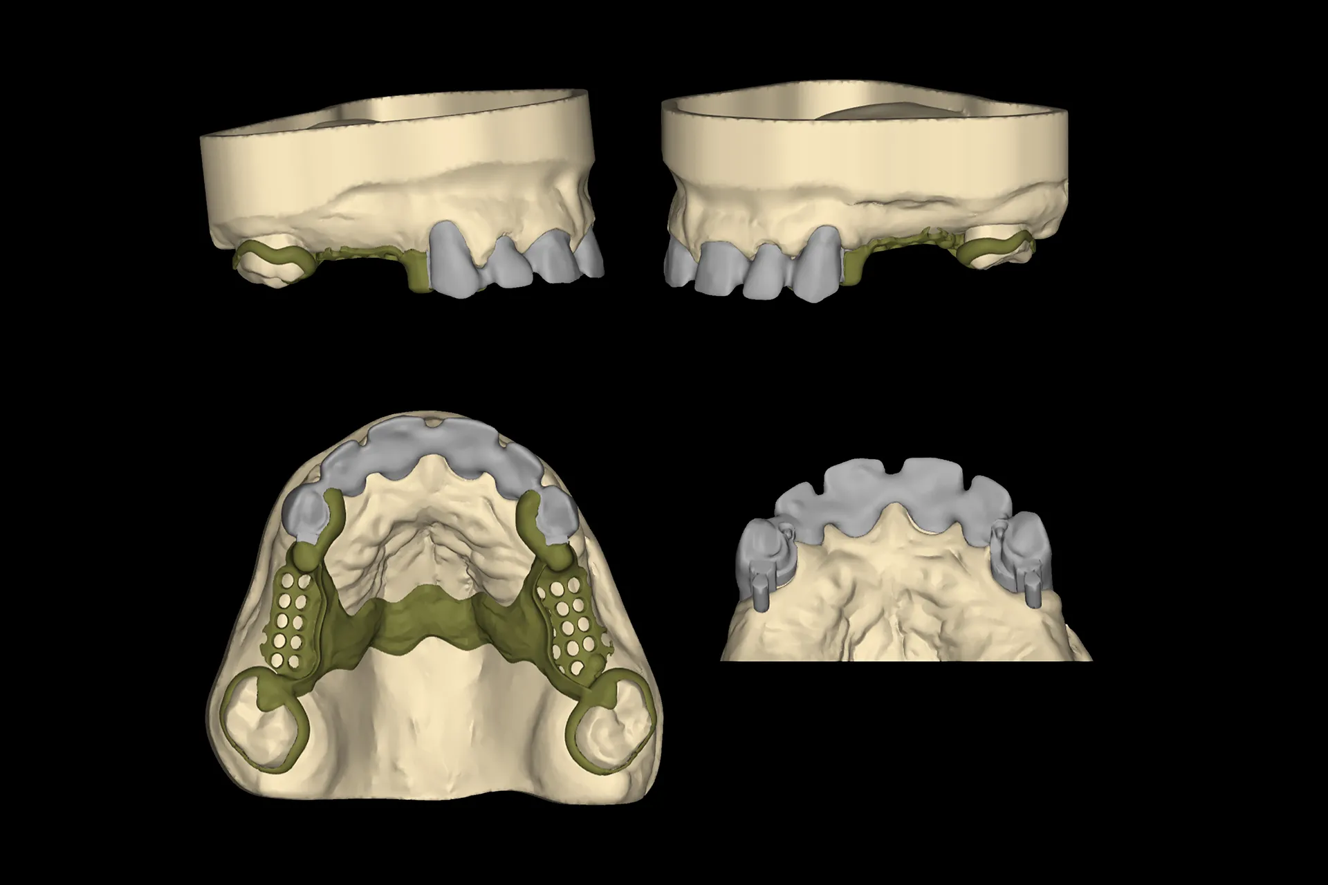 Cad 3