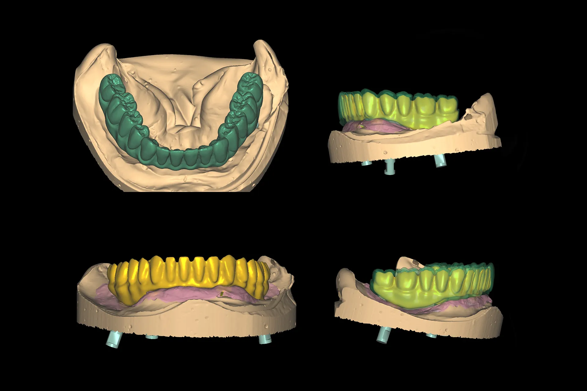 Cad 4