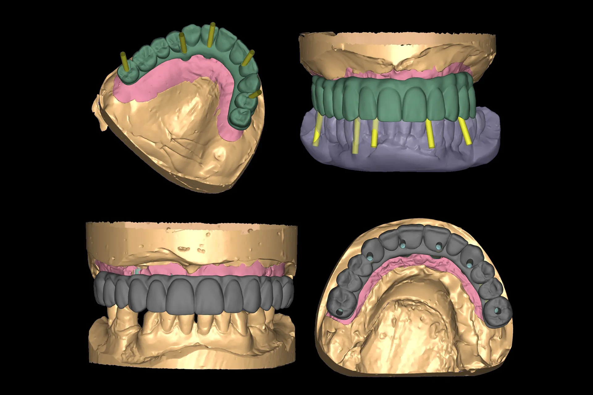 Cad 5