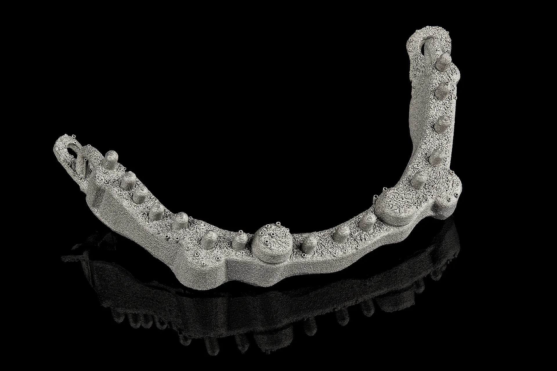 Slm dentures 1