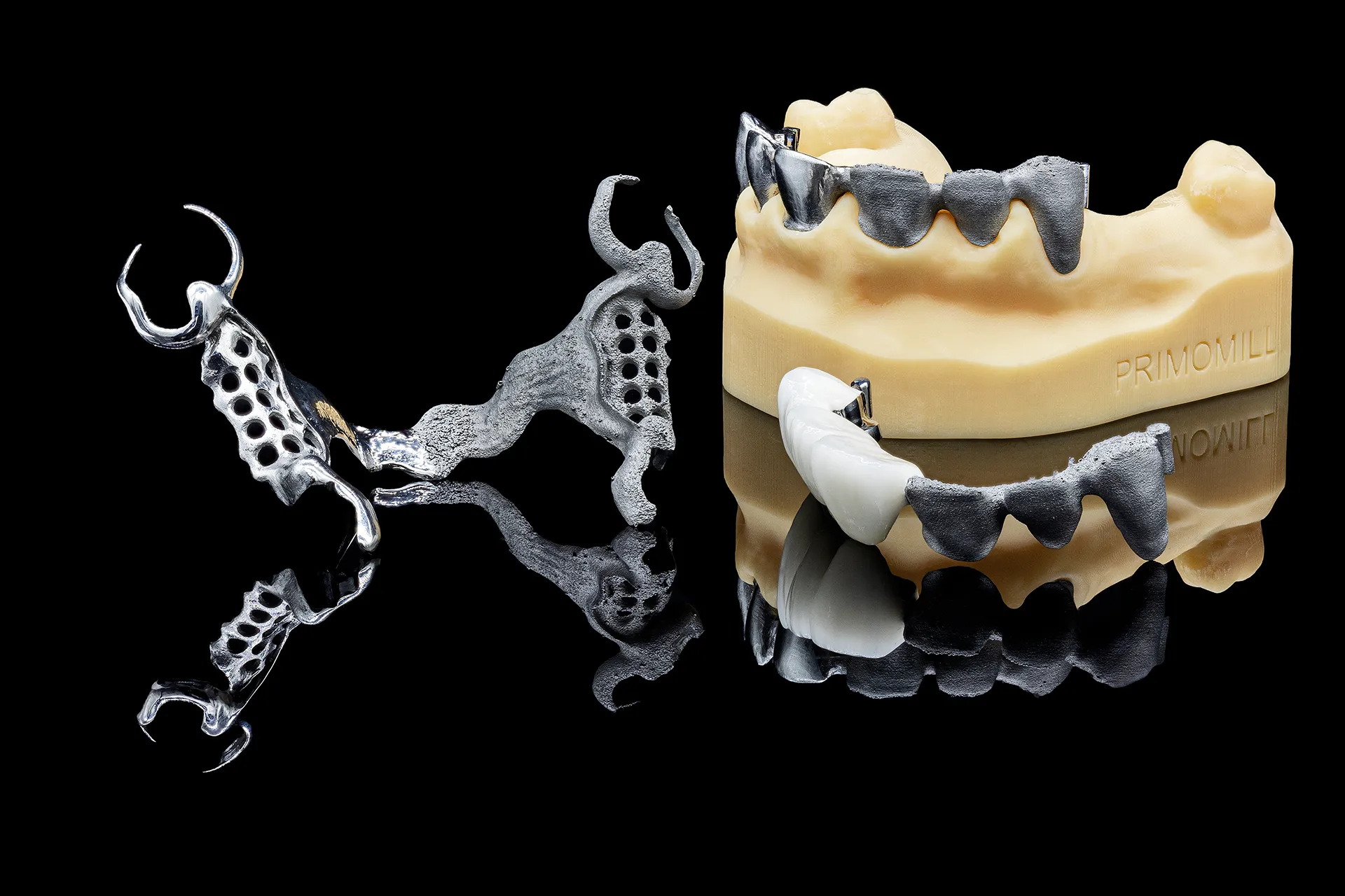 Slm dentures 3